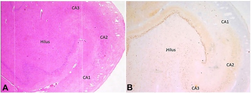 Photomicrography of the Central Nervous System - hippocampal region. A - Complete neuronal cell loss in CA1, marked depletion of neurons in CA3 and Hilus, and preserved neurons of the CA2 region of Hippocampus (H&E, 100x); B - NeuN highlights complete neuronal cell loss in CA1, marked depletion of neurons in CA3 and Hilus, and preserved neurons of the CA2 region of Hippocampus (100x).