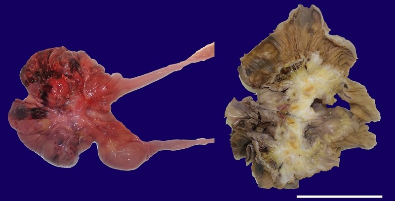 Gross view of the 20cm section of the affected bowel loop, with two images for comparison. On the left, a non-fixated picture clearly shows the retraction and bleeding. A formalin fixated picture after a mid-section cut is displayed on the right. Notably, the image on the right reveals the replacement of mesenteric adipose tissue with pearly-white tissue, engorging enlarged regional lymph nodes, the rectification of vasculature, and contact with the bowel wall. These enlarged regional lymph nodes have a yellowish appearance with a darker center. Scale bar= 10 cm.