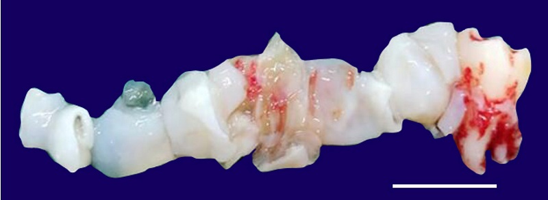 Gross view of the biopsy. Scale bar = 2 cm.