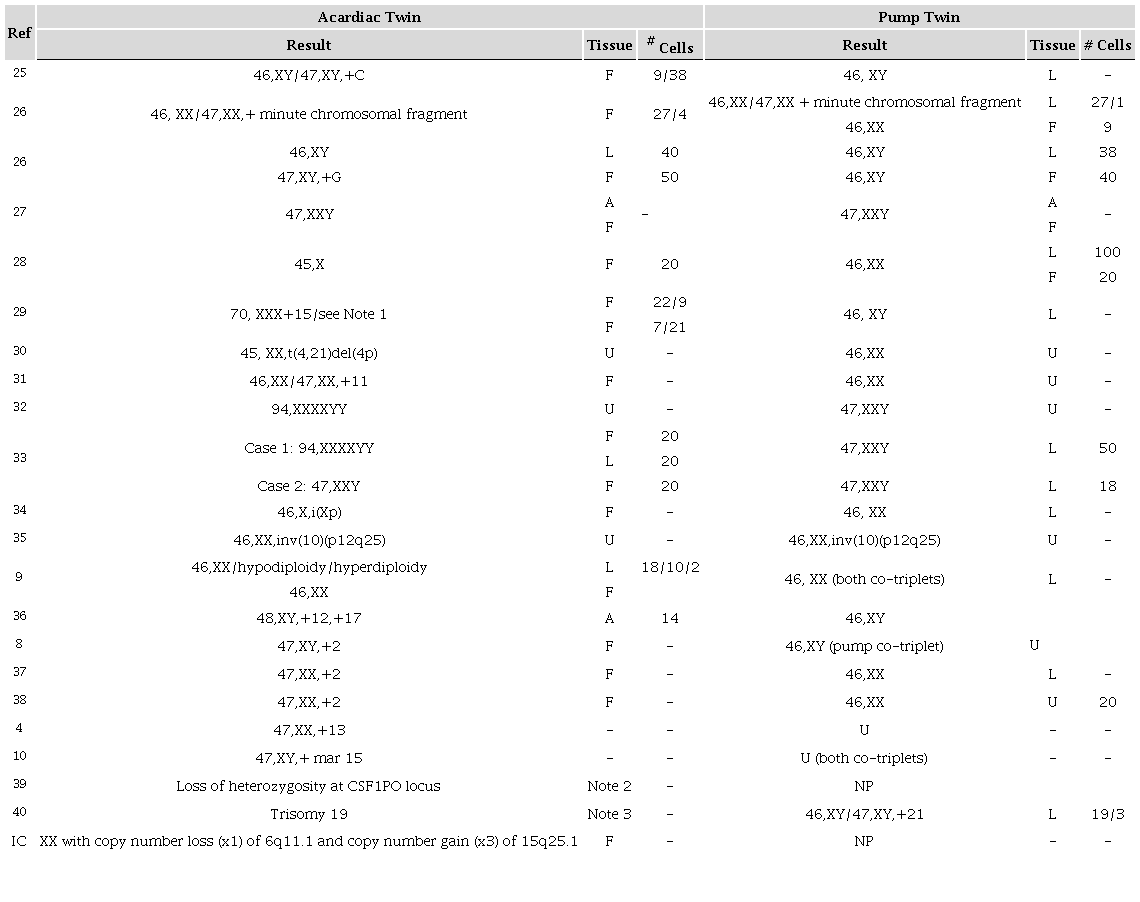 Genetic anomalies identified in acardiac twins