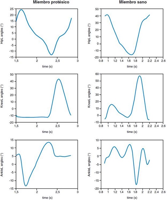 Ejemplo de valores angulares en función del tiempo obtenidos para lado sano y protetizado durante un ciclo a velocidad autoseleccionada.