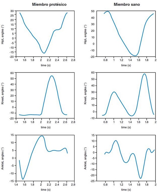 Ejemplo de valores angulares en función del tiempo obtenidos para lado sano y protetizado durante un ciclo a velocidad rápida.