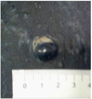 Formación nodular en cara lateral de muslo izquierdo.