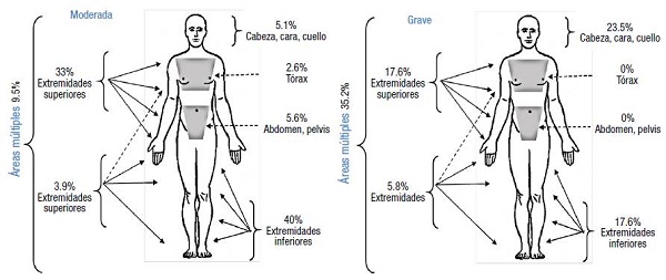 Regiones corporales afectadas de acuerdo a la gravedad de la lesión.