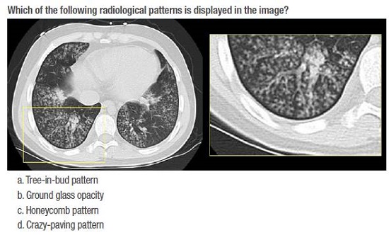 Example of the type of question used in the exams.