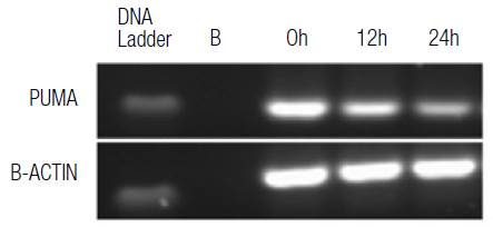 Relative PUMA mRNA expression. HT29 cells were treated with 200 μM H2O2 at different times, evaluated by conventional PCR for PUMA and compared to the b-actin gene expression in agarose gel.