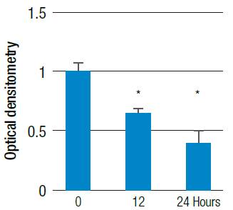 Relative PUMA mRNA expression. HT29 cells were treated with 200 μM H2O2 at different times and evaluated by conventional PCR for PUMA.