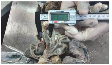 Measurement of vascular diameters and intervascular distances.