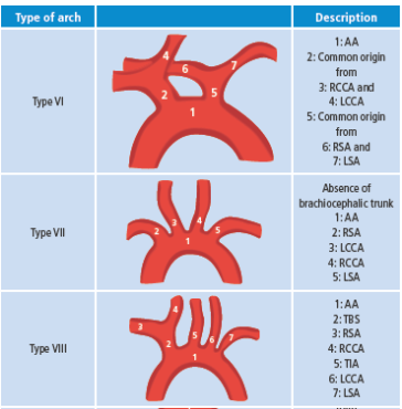 Representation of anatomical variations.