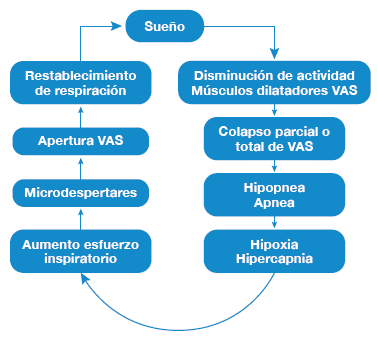 Fisiopatología del síndrome de apnea-hipopnea obstructiva del sueño. VAS: vía aérea superior.