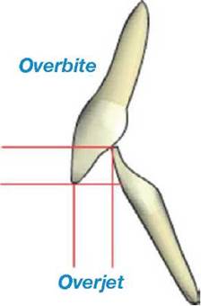 Evaluación de la posición de los dientes.