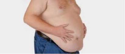 Obesidad central en síndrome de apnea-hipopnea obstructiva del sueño.