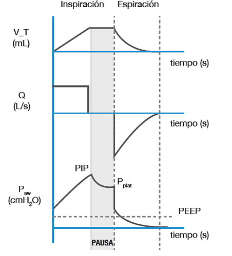 Curvas de volumen, flujo y presión. Se ilustra una pausa al final de la inspiración que permite el cálculo de la compliancia del sistema ventilatorio y la resistencia de la vía aérea.