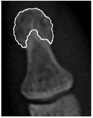 Apariencia radiogr&aacute;fica del penacho normal. 