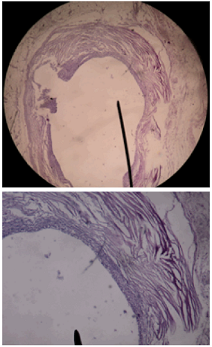 Tinción hematoxilina-eosina.