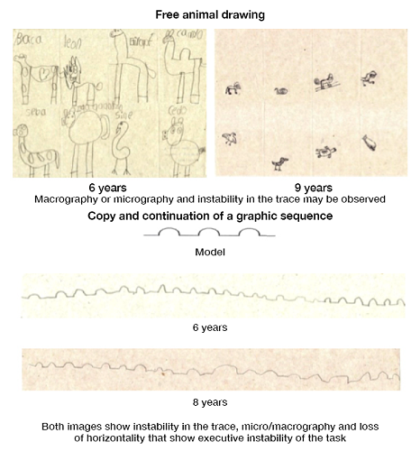 Examples of common error types in perceptual graphic tasks. Source: Own elaboration based on the data obtained in the study.