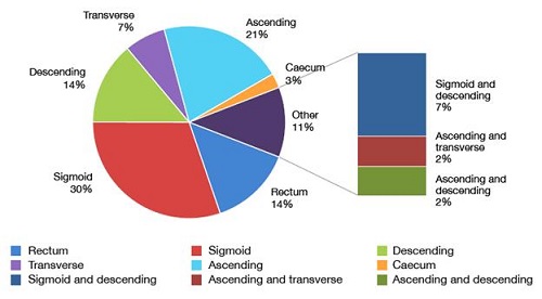 Percentage of polyps <1cm in colon segments. 
