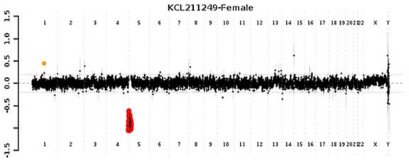 Graphical representation of the result for comparative genomic hybridization by microarray.