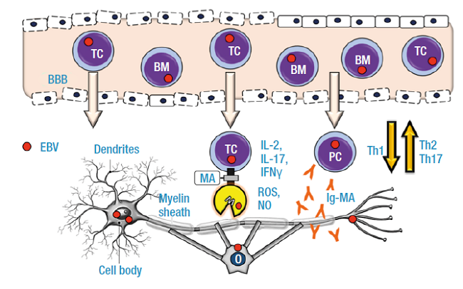 Patogénesis de la esclerosis múltiple.