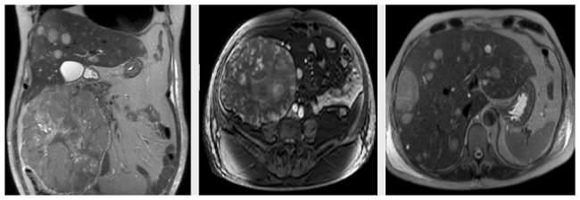 Contrast abdomen MRI.