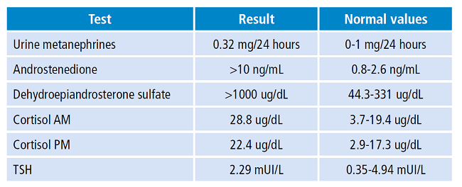 Hormonal profile of the patient on admission.