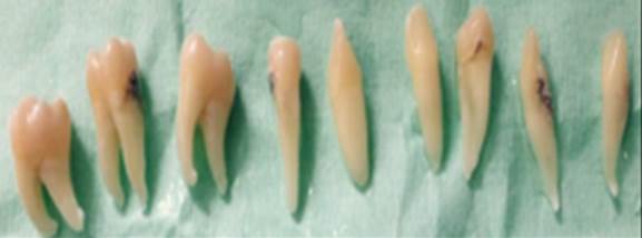 rganos dentarios extrados mediante intervencin quirrgica
