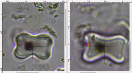 Imagen de aplicacin de medida de ancho y largo con el sistema AmScope