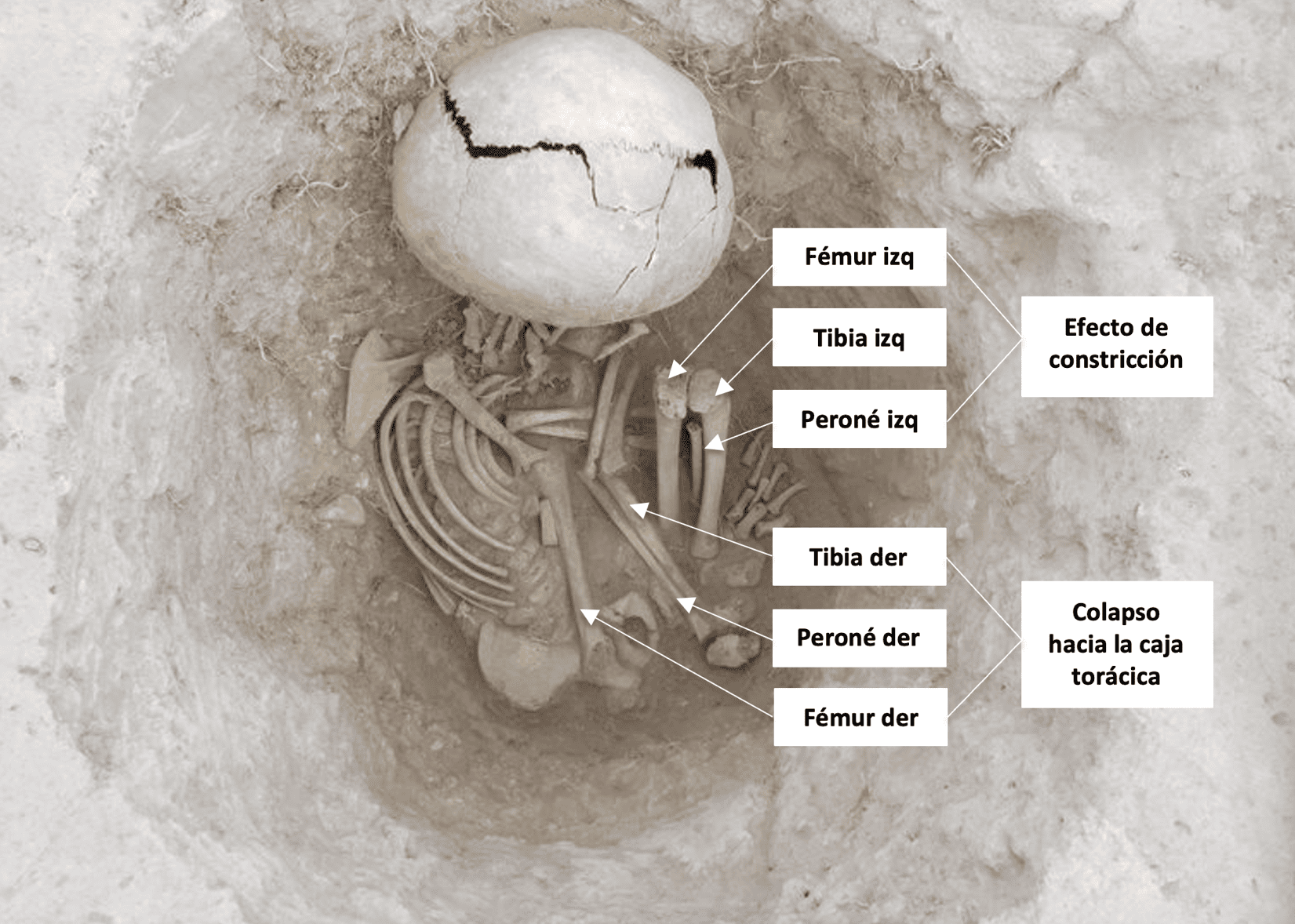 Posici�n de las piernas del individuo 8, enterramiento 4