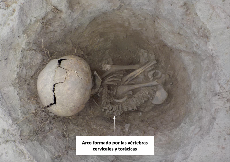 Arco formado por las v�rtebras cervicales y tor�cicas del individuo 8