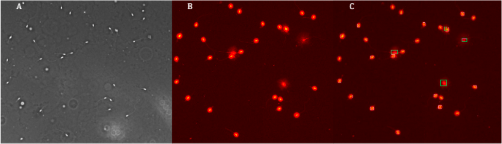 A. An�lisis de Espermatozoides vista simple contraste de fase vista 250X. B. Espermatozoides sometidos al tratamiento con el Kit Sperm-Halomax  � y te�idos con el kit de fluorescencia Fluored  �   HT-RFS100 vista 250X C. Espermatozoides detectados con el m�dulo fragmentaci�n, presencia de halo indicador de fragmentaci�n de ADN esperm�tica, espermatozoides sin halo normales, vista microscopio de fluorescencia (Axio Scope.A2 - Carl Zeiss Microscope Fluoresence) objetivo fluorita vista 250X longitud de onda excitaci�n a 300nm, emisi�n 595nm.