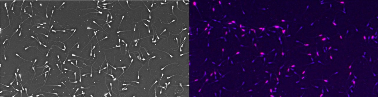 A. An�lisis de Espermatozoides vista simple contraste de fase. B. Espermatozoides sometidos a la tinci�n Kit Hoechst 33342/PI Double Stain Apoptosis Detection detectados en el m�dulo an�lisis viabilidad AndroVision en microscopio de fluorescencia, espermatozoides te�idos violeta (Muertos) ya que el colorante solo es permeable en c�lulas muertas, Espermatozoides azules (Vivos) vista microscopio de fluorescencia (Axio Scope.A2 - Carl Zeiss Microscope Fluoresence) objetivo fluorita vista 250X, longitud de onda para el colorante Hoescht 33342 fluorescencia azul longitud de onda excitaci�n a 350nm, emisi�n 461nm, y Yoduro de propidio (PI) fluorescencia roja longitud de onda excitaci�n a 535nm, emisi�n 617nm.