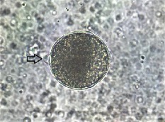 Huevo fecundado de C gigas Se observa el primer cuerpo polar flecha 400x sin tinci�n