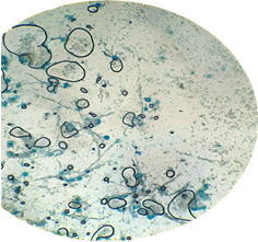 Taxonoma de microorganismo con morfologa de hongo, observado en el lente 100 X