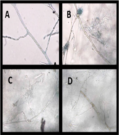  micelio de Phytophthora capsici sin antagonistas, B) micelio de P. capsici con Penicillium spp., C) y D) micelio de P. capsici en proceso de desintegración.