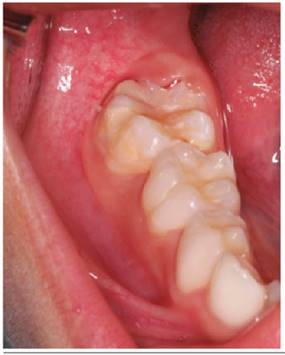 Control a los 7 meses.