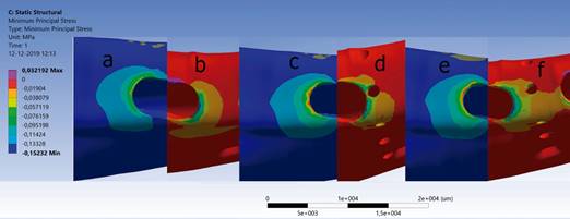 a) tracci&oacute;n &oacute;sea modelo 1, b) compresi&oacute;n &oacute;sea modelo 1, c) tracci&oacute;n &oacute;sea modelos 2, d) compresi&oacute;n &oacute;sea modelo 2, e) tracci&oacute;n &oacute;sea modelo 3, f) compresi&oacute;n &oacute;sea modelo 3.