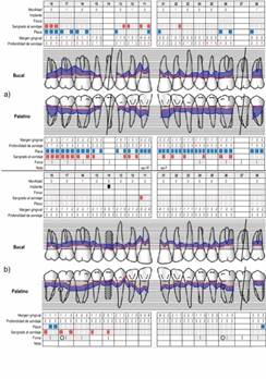 a) Periodontograma maxilar inicial año 2010. b) Periodontograma maxilar de TSP año 2019. Implante dental diente 1.4