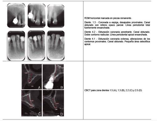 Estudios imagenológicos.