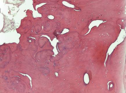 Microfotografía de corte histológico con tinción de hematoxilina-eosina x200.