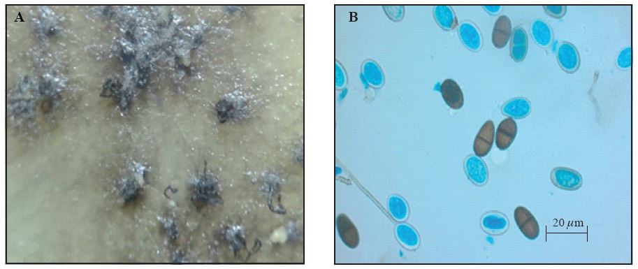 Estructuras de Lasiodiplodia theobromae en aislado proveniente de papaya. A) Micelio y picnidios en PDA a 14 días de crecimiento. B) Conidios maduros e inmaduros a 14 días de crecimiento.