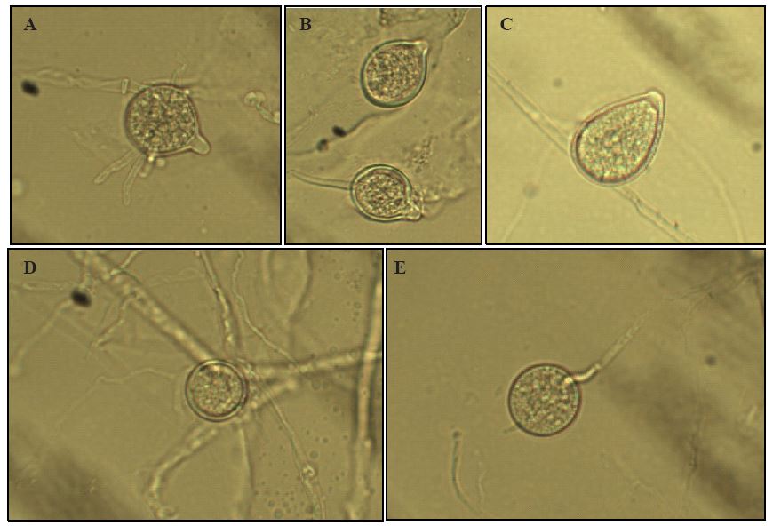 Estructuras asexuales de Phytophthoranicotianae. A) Esporangio esf&eacute;rico. B) Esporangio limoniforme. C) Esporangio ovoide. D) Clamidospora intercalar. E) Clamidospora terminal.