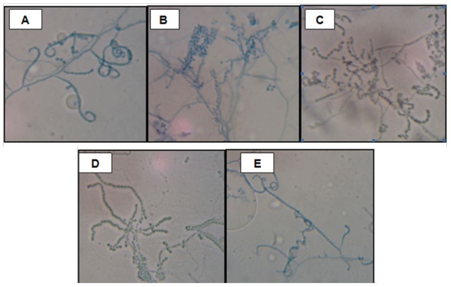 Observaci&oacute;n microsc&oacute;pica de los actinomicetos seleccionados por su mayor actividad antimicrobiana frente a fitopat&oacute;genos de S. tuberosum. Cepas AACI-5 (A); ACZI-22 (B); ACZII-35 (C); ACZIII-84 (D) y ACZIII-88 (E). Aumento: 1000X.