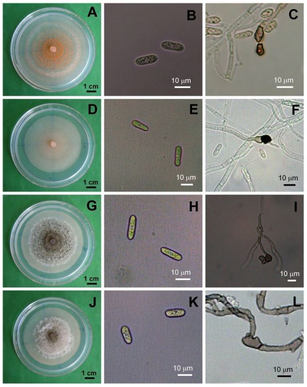 Morfolog&iacute;a colonial (A, D, G, J), conidios (B, E H, K) y apresorios miceliales (C, F, I, L) de cuatro aislamientos representativos M26 (A, B, C), 28 (D, E, F), 29 (G, H, I), 30 (J, K, L) de Colletotrichum gloeosporioides de frutos de litchi, despu&eacute;s de cinco d&iacute;as en PDA.