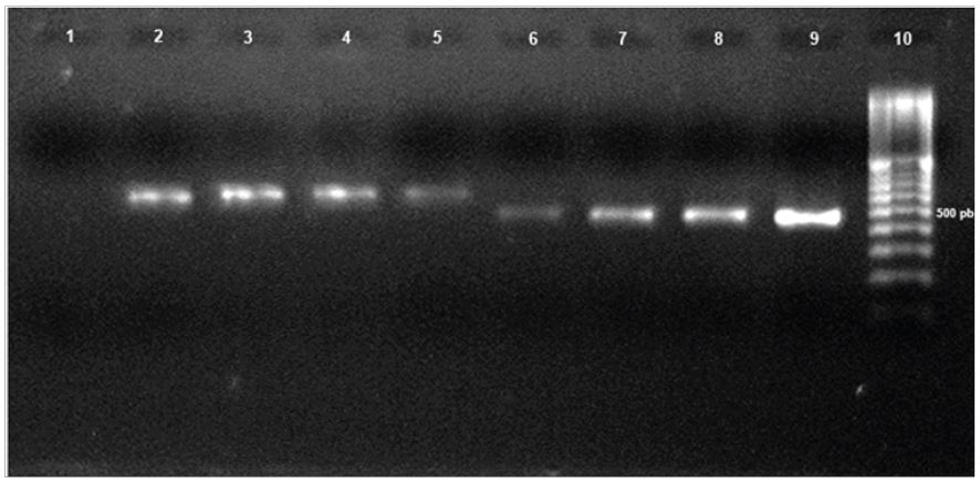 Producto de PCR de cuatro aislamientos caracter&iacute;sticos (M26, M28, M29, y M30) de Colletotrichum gloeosporioides. Lineas: 1) Control (H2O PCR); 2) M26- ITS4/ITS5; 3) M28- ITS4/ITS5; 4) M29- ITS4/ITS5; 5) M30- ITS4/ITS5; 6) M26- ITS4-CgInt; 7) M28- ITS4-CgInt; 8) M29- ITS4-CgInt; 9) M30- ITS4-CgInt; 10) marcador de 100 pares de bases (bp) (Invitrogen).