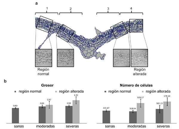 An&aacute;lisis cuantitativo del efecto de EuMV-YP. Secci&oacute;n transversal de una hoja (A). Gr&aacute;ficas de grosor de la l&aacute;mina foliar y del n&uacute;mero de c&eacute;lulas (B) en plantas con s&iacute;ntomas moderados, severos o sanas. Se incluyen barras de error de desviaci&oacute;n est&aacute;ndar.
