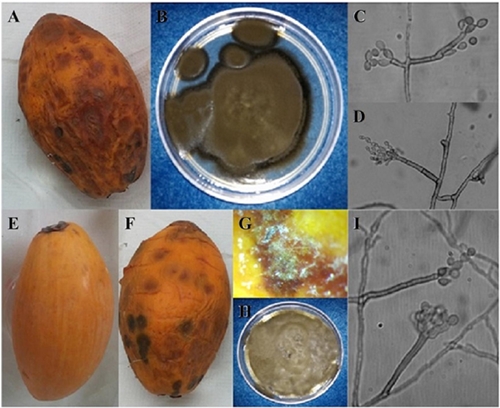 Caracterizaci&oacute;n morfol&oacute;gica y pruebas de patogenicidad de Cladosporium cladosporioides en frutos de zapote mante (Pouteria campechiana) en Ciudad Mante, Tamaulipas, M&eacute;xico. A) Fruto con manchas hundidas de color marr&oacute;n; B) Aislamiento MTCc; C y D) Conidi&oacute;foros macronematosos nodulosos y conidios elipsoidales de Cladosporium cladosporioides. E-I) Pruebas de patogenicidad; E) Fruto utilizado como testigo; F) Fruto inoculado con zonas hundidas de color marr&oacute;n; G) Presencia de estructuras morfol&oacute;gicas del aislamiento MTCc en fruto inoculado; H) Reaislamiento obtenido de fruto inoculado en pruebas de patogenicidad; I) Conidi&oacute;foros y conidios de Cladosporium cladosporioides. 