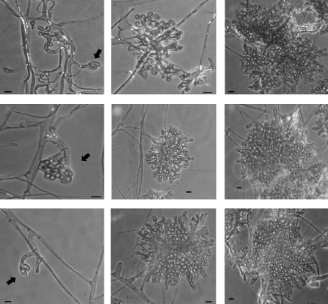 Estructuras microsc&oacute;picas de desarrollo durante la formaci&oacute;n de esclerocios de Sclerotinia sclerotiorum, despu&eacute;s de siete d&iacute;as de crecimiento del hongo. La primera (que indican las flechas), la segunda y la tercera estructura del desarrollo de esclerocios en presencia de KHCO3: (A-C) 2 mM, (D-F) 4 mM, y (G-I) 6 mM. Se tomaron microfotograf&iacute;as en un microscopio de contraste de fase a 40X de ampliaci&oacute;n. Barras = 10 &micro;m.