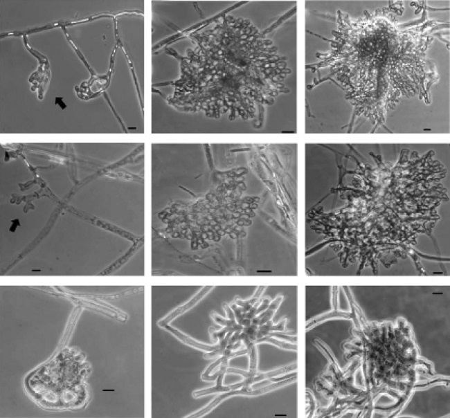 Se observaron estructuras microsc&oacute;picas de desarrollo durante la formaci&oacute;n de esclerocios de Sclerotinia sclerotiorum, despu&eacute;s de siete d&iacute;as de crecimiento del hongo. La primera (que indican las flechas), la segunda y la tercera estructura del desarrollo de esclerocios en presencia de KHCO3: (A-C) 8 mM, y (D-F) 10 mM. A la dosis de 25 mM se observ&oacute; desorganizaci&oacute;n celular del primordio (G-I), en la cual no se observaron ni la segunda ni la tercera estructura de desarrollo de los esclerocios. Las microfotograf&iacute;as fueron tomadas en un microscopio de contraste de fases a 40X de ampliaci&oacute;n. Barras = 10 μm