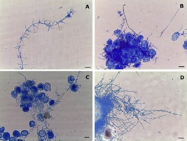 Micopar&aacute;sitos encontrados en p&uacute;stulas de Roya del Cafeto (Hemileia vastatrix) y sus caracter&iacute;sticas morfol&oacute;gicas en Avena-Agar. D&oacute;nde: Lecanicillium sp. (A-40X); Calcarisporium sp. (B-40X); Simplicillium sp. (C-40X) y Sporothrix sp. (D-40X). Barra: 10 &micro;m