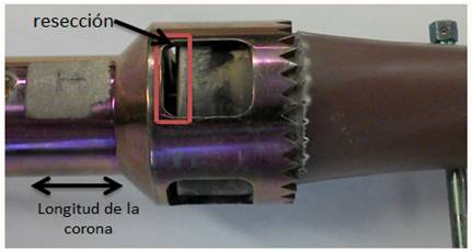 Vista de la longitud de la corona y la
calidad de la resección, Laboratorio de Biomecánica 2014.
